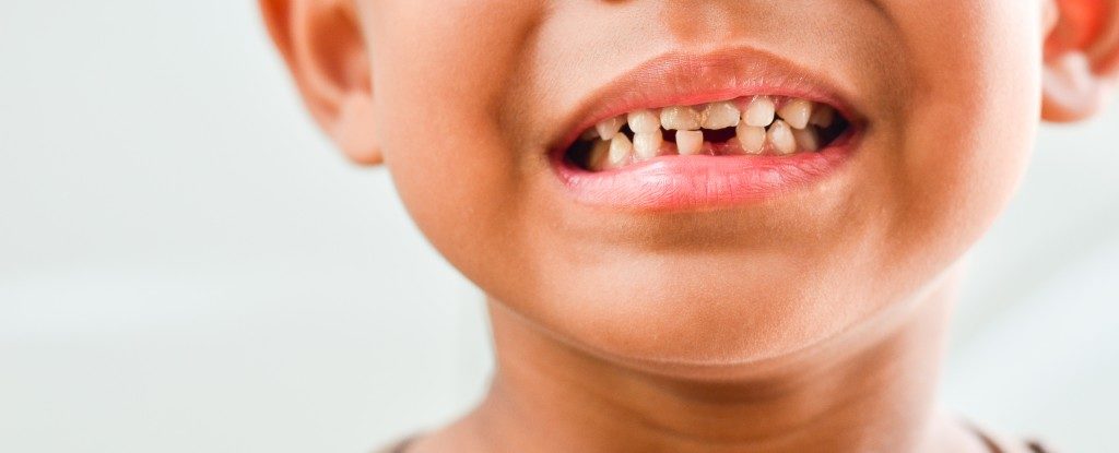 child's damaged teeth
